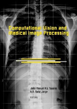 portada computational vision and medical image processing: vipimage 2007 (en Inglés)