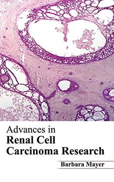 portada Advances in Renal Cell Carcinoma Research