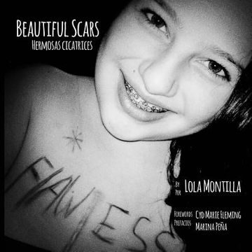 portada Beautiful Scars | Hermosas Cicatrices (english And Spanish Edition) (in English)