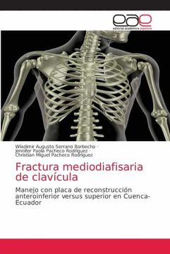 portada Fractura Mediodiafisaria de Clavícula: Manejo con Placa de Reconstrucción Anteroinferior Versus Superior en Cuenca- Ecuador