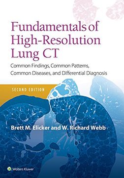 portada Fundamentals of High-Resolution Lung ct: Common Findings, Common Patterns, Common Diseases and Differential Diagnosis (Pocket Not) (en Inglés)