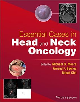 portada Essential Cases in Head and Neck Oncology (en Inglés)