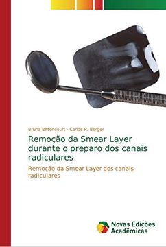 portada Remoção da Smear Layer Durante o Preparo dos Canais Radiculares (en Portugués)