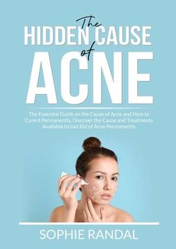 portada The Hidden Cause of Acne: The Essential Guide on the Cause of Acne and How to Cure it Permanently, Discover the Cause and Treatments Available t (en Inglés)