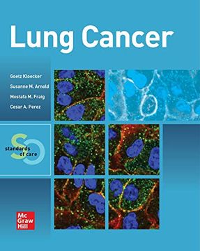 portada Lung Cancer: Standards of Care (in English)