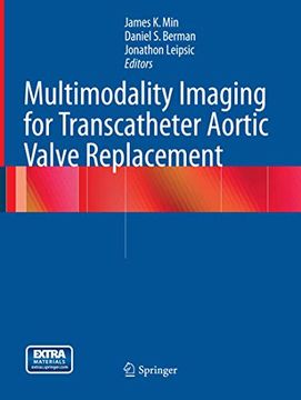 portada Multimodality Imaging for Transcatheter Aortic Valve Replacement (en Inglés)