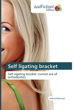 portada Self ligating bracket (in English)