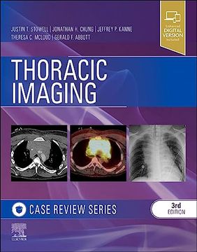 portada Thoracic Imaging: Case Review (en Inglés)