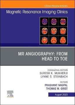 portada Mr Angiography: From Head to Toe,An Issue of Magnetic (in English)