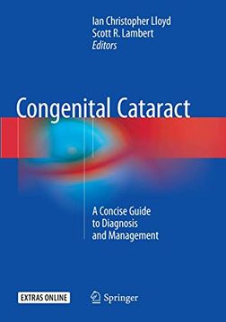 portada Congenital Cataract: A Concise Guide to Diagnosis and Management (in English)