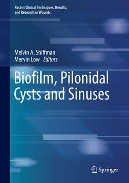 portada Biofilm, Pilonidal Cysts and Sinuses (in English)