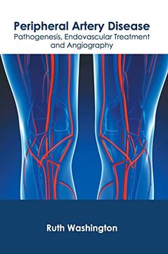 portada Peripheral Artery Disease: Pathogenesis, Endovascular Treatment and Angiography (en Inglés)