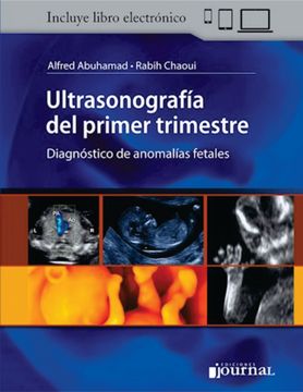 portada Ultrasonografía del Primer Trimestre. Diagnóstico de anomalías fetales (in Spanish)