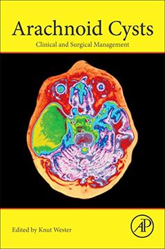 portada Arachnoid Cysts: Clinical and Surgical Management