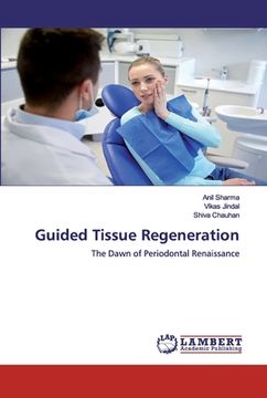 portada Guided Tissue Regeneration (en Inglés)
