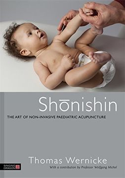 portada Shonishin: The Art of Non-Invasive Paediatric Acupuncture (en Inglés)