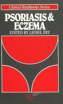 portada Psoriasis and Eczema (Clinical Handbook s. ) de Tony Lane