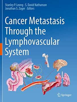 portada Cancer Metastasis Through the Lymphovascular System