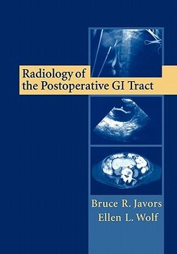 portada radiology of the postoperative gi tract