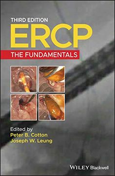 portada Ercp: The Fundamentals (en Inglés)