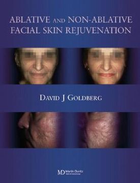 Ablative and Non-Ablative Facial Skin Rejuvenation (en Inglés)