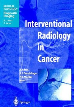 portada interventional radiology in cancer (en Inglés)