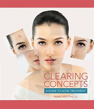 portada Clearing Concepts: A Guide to Acne Treatment (en Inglés)