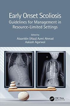 portada Early Onset Scoliosis: Guidelines for Management in Resource-Limited Settings (en Inglés)