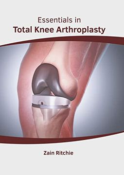 portada Essentials in Total Knee Arthroplasty (in English)