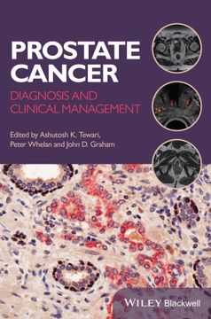 portada Prostate Cancer: Diagnosis and Clinical Management (en Inglés)