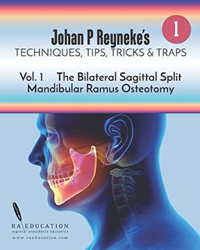 portada Johan p Reyneke'S Techniques, Tips, Tricks and Traps: Volume 1: The Bilateral Sagittal Split Mandibular Ramus Osteotomy (in English)