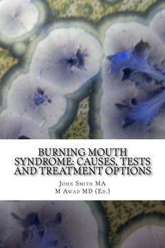 portada Burning Mouth Syndrome: Causes, Tests and Treatment Options