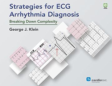 portada Strategies for ecg Arrhythmia Diagnosis: Breaking Down Complexity (en Inglés)