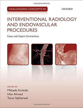 portada Challenging Concepts in Interventional Radiology