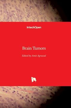 portada Brain Tumors (en Inglés)