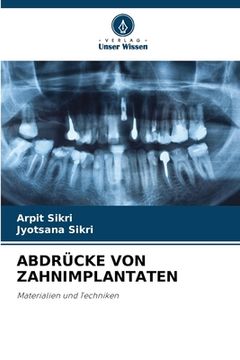 portada Abdrücke Von Zahnimplantaten (in German)