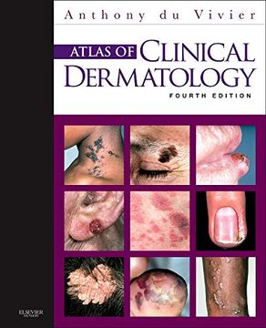 portada Atlas of Clinical Dermatology (du Vivier, Atlas of Clinical Dermatology) 