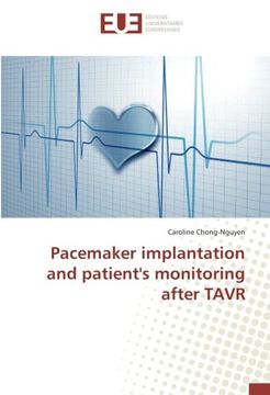 portada Pacemaker implantation and patient's monitoring after TAVR