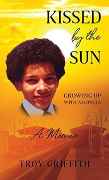 portada Kissed by the Sun: Growing up With Alopecia (in English)
