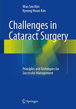 portada Challenges in Cataract Surgery: Principles and Techniques for Successful Management (en Inglés)