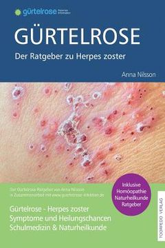 portada Gürtelrose - Der große Ratgeber zu Herpes zoster: Schulmedizin + Naturheilkunde (en Alemán)