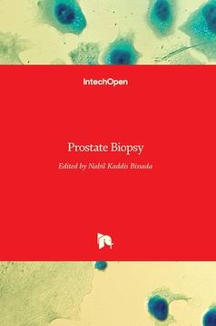 Prostate Biopsy (en Inglés)