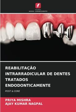 portada Reabilitação Intrarradicular de Dentes Tratados Endodonticamente