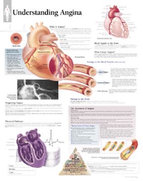 portada understanding angina chart: wall chart