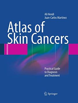 portada Atlas of Skin Cancers: Practical Guide to Diagnosis and Treatment (in English)
