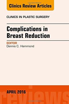 portada Complications in Breast Reduction, An Issue of Clinics in Plastic Surgery, 1e (The Clinics: Surgery)