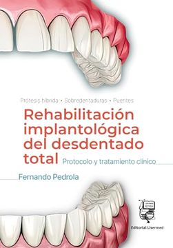 portada Rehabilitación Implantológica del Desdentado Total: Protocolo y Tratamiento Clínico