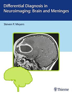 portada Differential Diagnosis in Neuroimaging: Brain and Meninges (en Inglés)