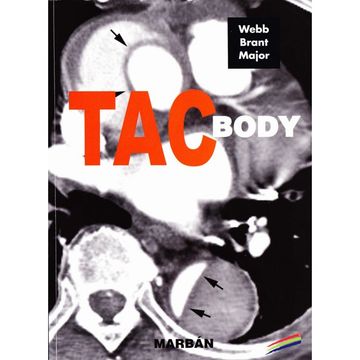 portada fundamentos de tac body -residente 15-