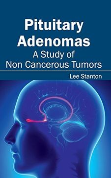 portada Pituitary Adenomas: A Study of non Cancerous Tumors (en Inglés)